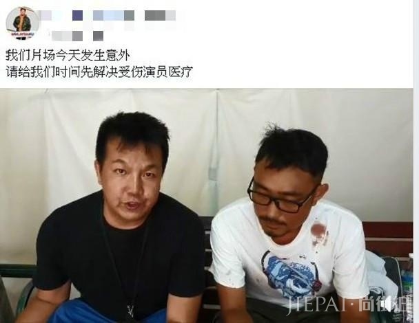 83经典版《射雕》穆念慈拍戏烧伤 面部伤明显