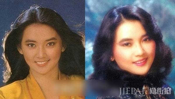 83经典版《射雕》穆念慈拍戏烧伤 面部伤明显