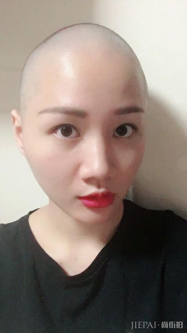 女生光头是种什么体验？从光头长到头发可以见人需要多久？