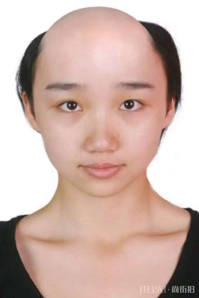 女生光头是种什么体验？从光头长到头发可以见人需要多久？
