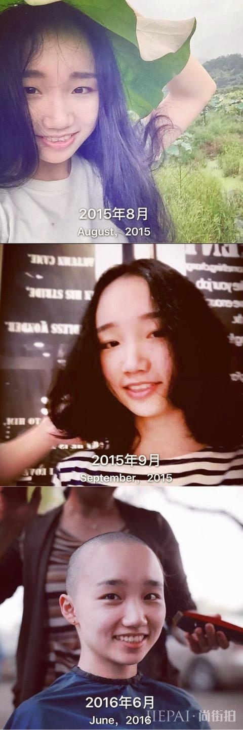 女生光头是种什么体验？从光头长到头发可以见人需要多久？