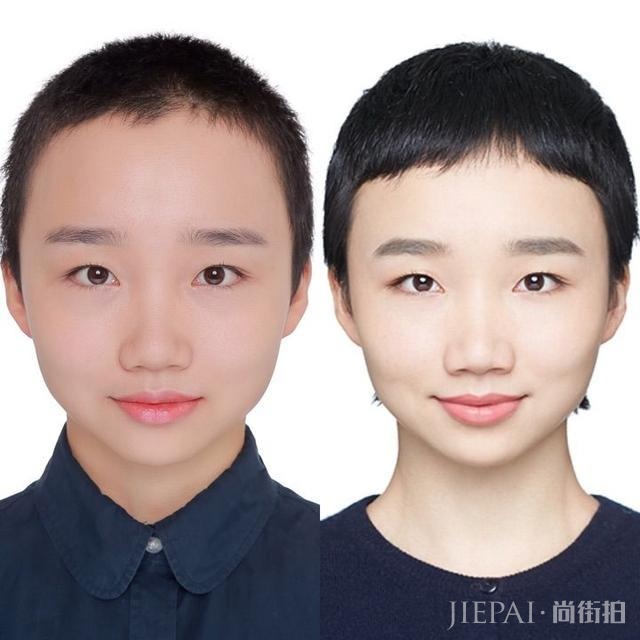 女生光头是种什么体验？从光头长到头发可以见人需要多久？