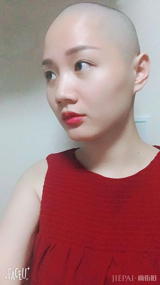 女生光头是种什么体验？从光头长到头发可以见人需要多久？