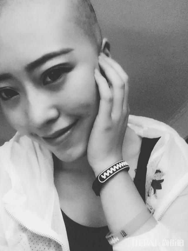 女生光头是种什么体验？从光头长到头发可以见人需要多久？