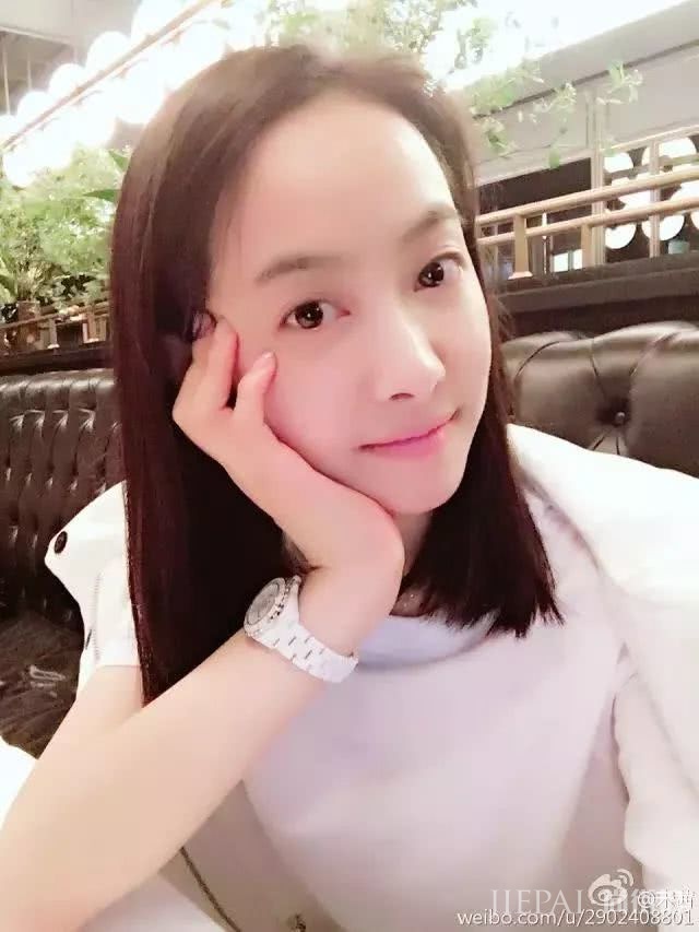 发际线后移怎么办？学宋茜和杨幂这两种应对方法最简单！