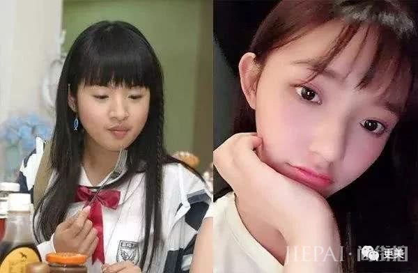 林允出演傻白甜袁湘琴,暴瘦凹陷后灵气全无的她是要毁经典?