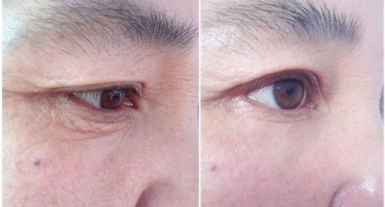 资生堂好用的产品推荐 盘点许三多那些收获好评的产品