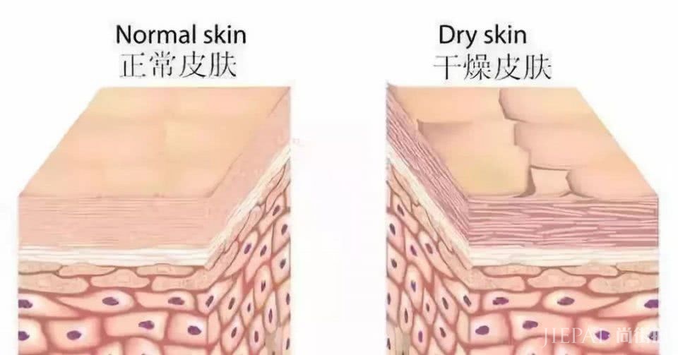 买了保湿爆款照样起干皮 ?揭秘那些被低估的保湿陷阱