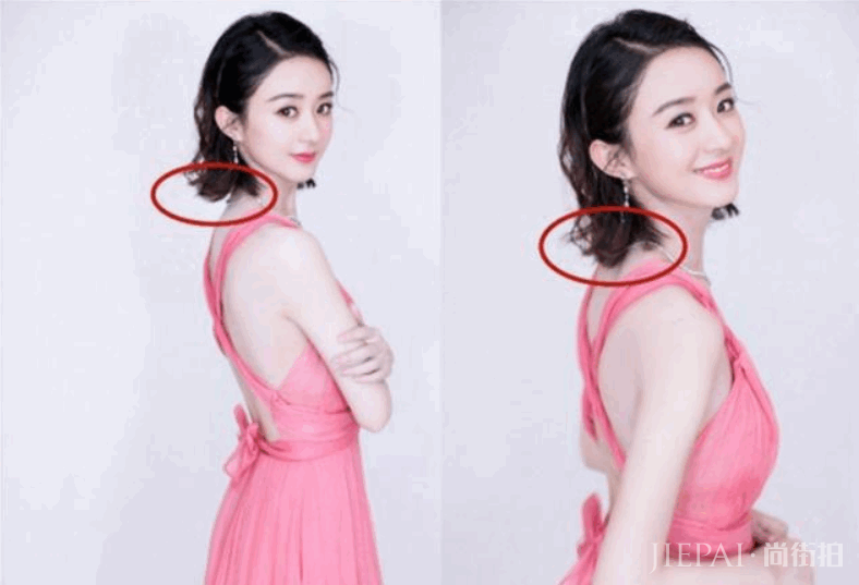 今年最流行的“摩卡波波头”，堪称瘦脸神器！