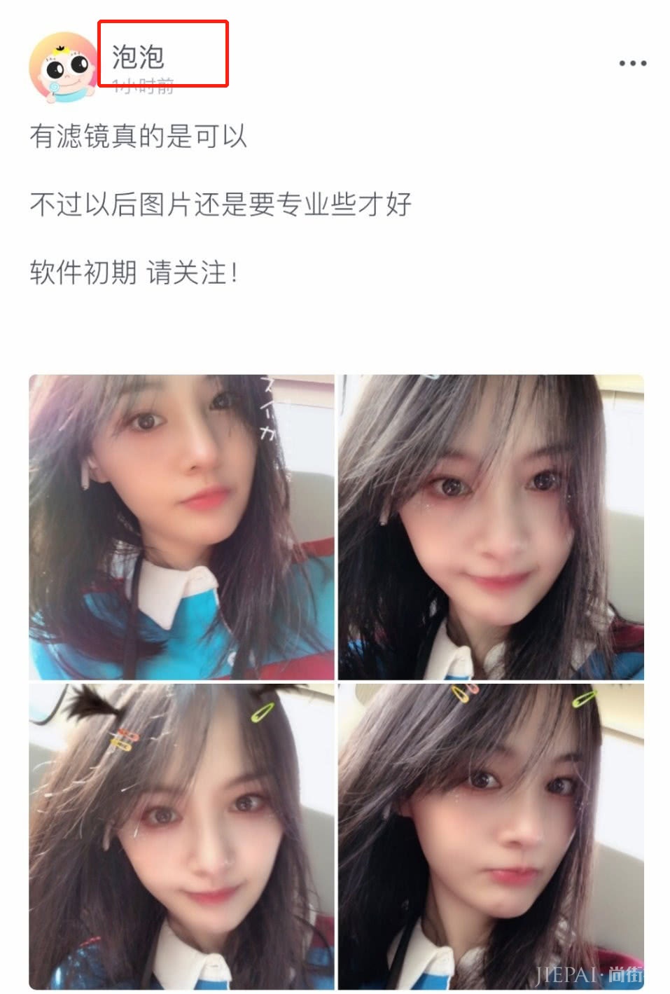 郑爽晒自拍掩盖嘴角伤疤,还意外暴露男友对她“爱的呼唤”