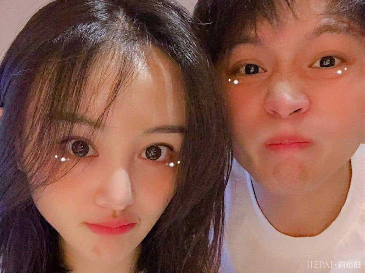 郑爽晒自拍掩盖嘴角伤疤,还意外暴露男友对她“爱的呼唤”