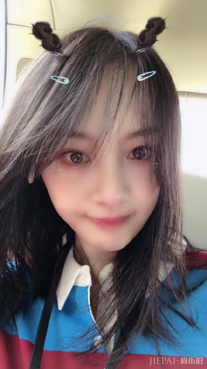 郑爽晒自拍掩盖嘴角伤疤,还意外暴露男友对她“爱的呼唤”