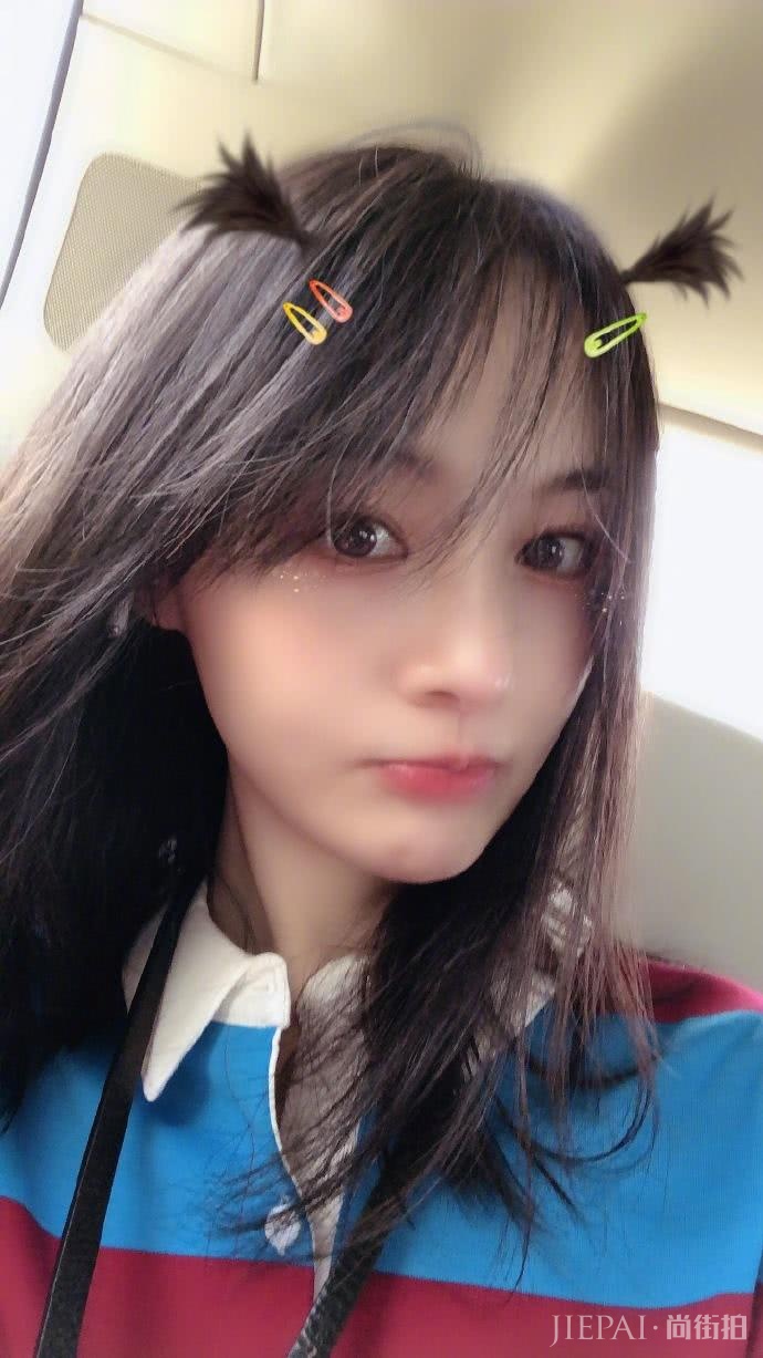 郑爽晒自拍掩盖嘴角伤疤,还意外暴露男友对她“爱的呼唤”