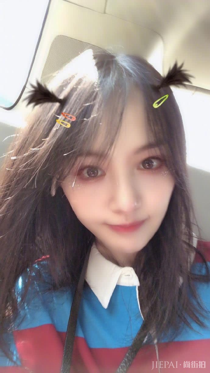 郑爽晒自拍掩盖嘴角伤疤,还意外暴露男友对她“爱的呼唤”