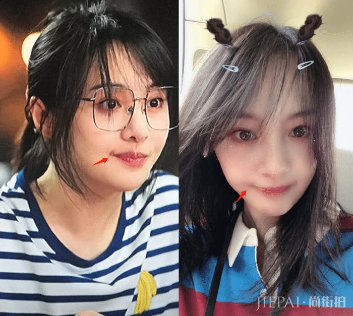 郑爽晒自拍掩盖嘴角伤疤,还意外暴露男友对她“爱的呼唤”