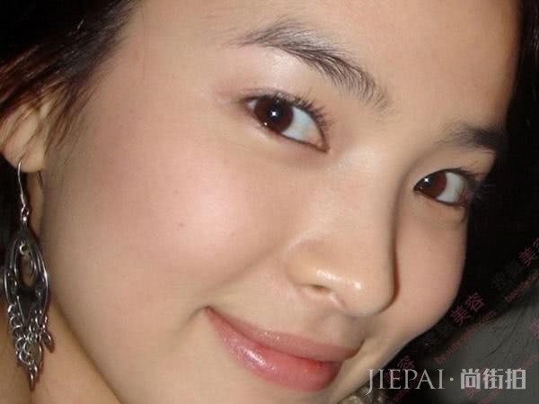 6个方法让你远离痘痘!睡美容觉真的有用