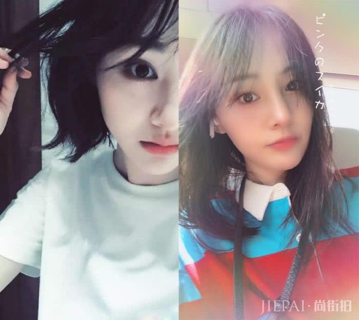 郑爽晒自拍掩盖嘴角伤疤,还意外暴露男友对她“爱的呼唤”