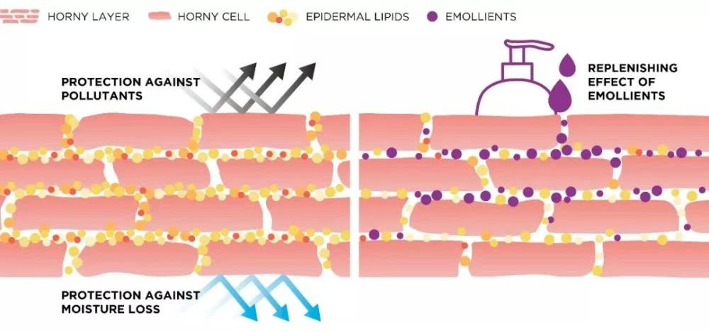 名门泽佳护肤重点之干性皮肤