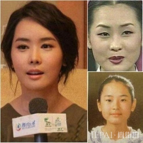 偶遇35岁李多海，皮肤好似少女，但脸又变了！撞脸王祖蓝老婆