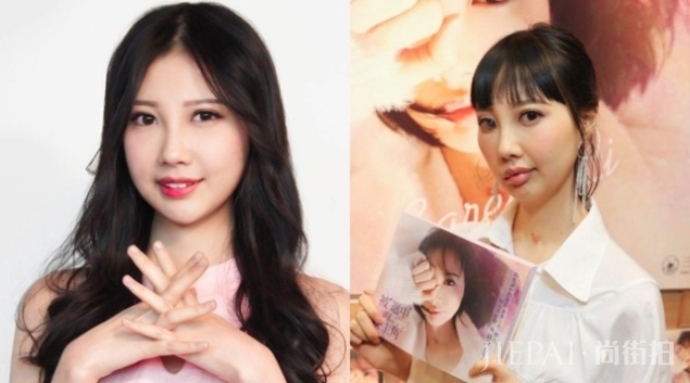 女歌手抗癌7年癌细胞扩散致面部瘫痪无法闭眼，为活命决定做手术