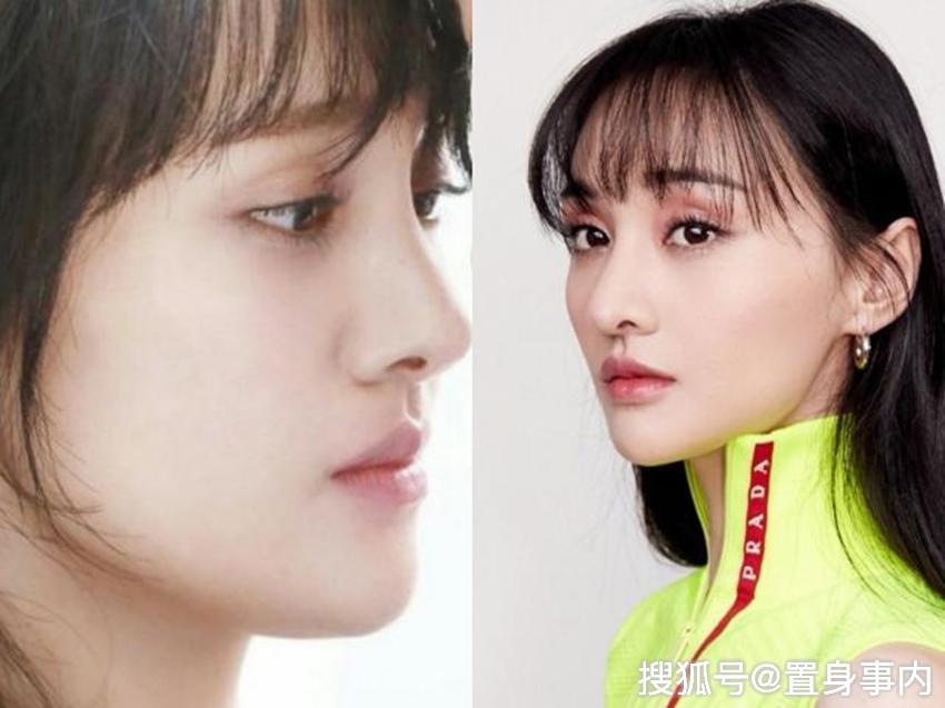 郑爽模样大变疑似整容,撞脸于小彤被嘲像网红,还是当年的她看好