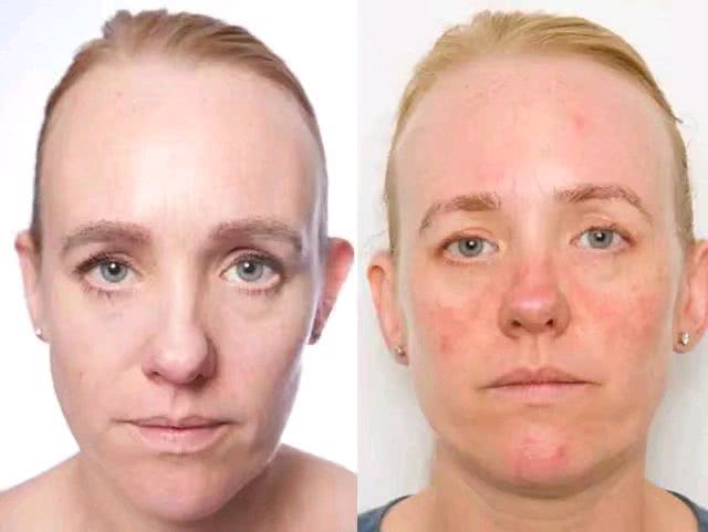 会化妆更要会卸妆,不然下一个烂脸的就是你