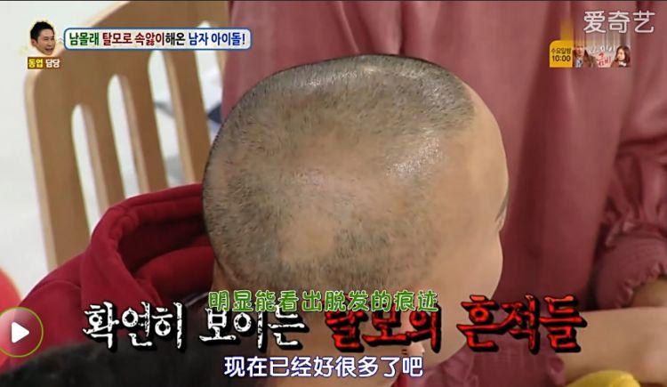 21岁红得发紫,被公司压榨丑成大妈?仙女人设崩了?