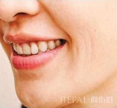 护肤排毒很重要,脸上几种状况告诉你要排毒了