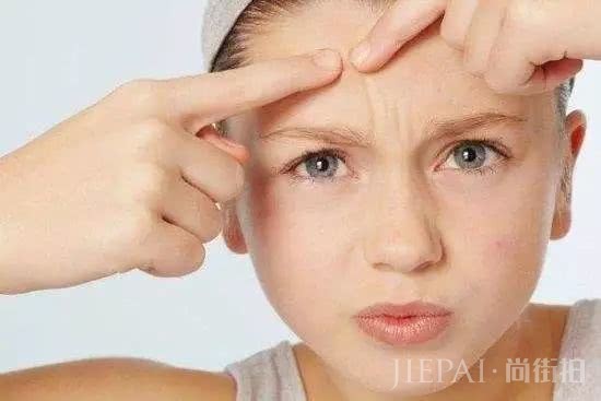 护肤排毒很重要,脸上几种状况告诉你要排毒了