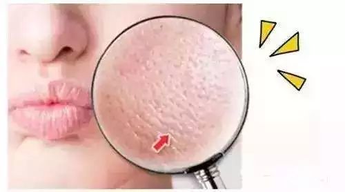 护肤排毒很重要,脸上几种状况告诉你要排毒了