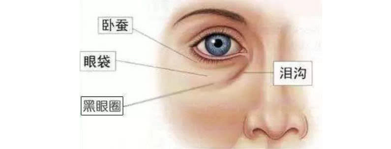 女人脸上有这“三道纹”，看起来比实际年龄大10岁，姐姐变阿姨