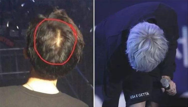 21岁红得发紫,被公司压榨丑成大妈?仙女人设崩了?