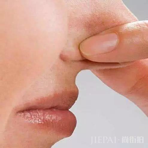 护肤排毒很重要,脸上几种状况告诉你要排毒了