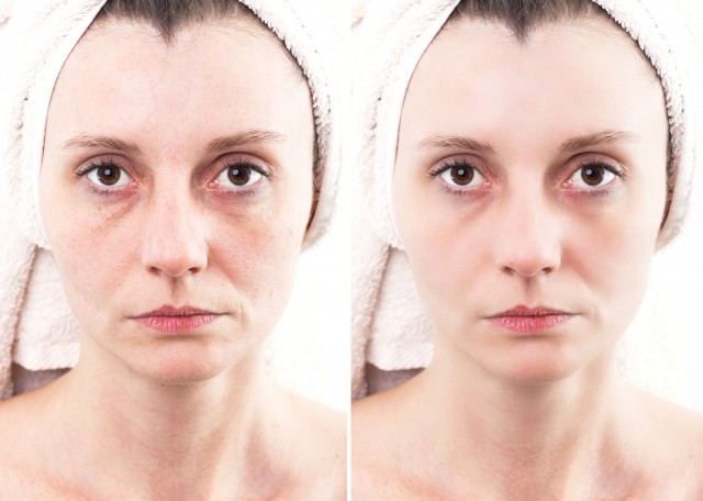 去黑头的简单小妙招,让自己的皮肤更好,试试这几招