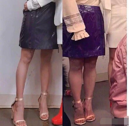 小美女沈月被爆做腿部吸脂,萝卜腿消失引质疑,女明星为了身材太拼了