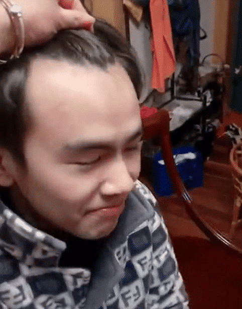 网红小哥哥的发际线火了？网友表示眼瞎了