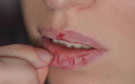 涂口红前，有必要“润唇”吗？不少人还不信，难怪唇纹深还起皮！