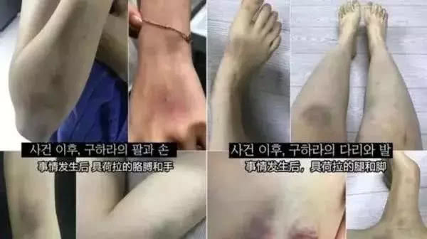 具荷拉去世15天，哥哥晒其童年照：我们荷拉小时候也很漂亮，想你