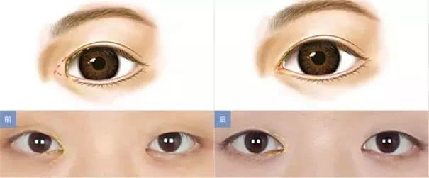 拯救单眼皮新娘的化妆术,简单易学又好看