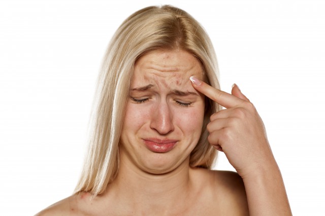 抬头纹如何消除，6个方法有效改善抬头纹