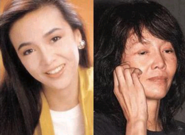 天生就很美丽却还执意整容,结果变得更丑了,这些女星太可怜!