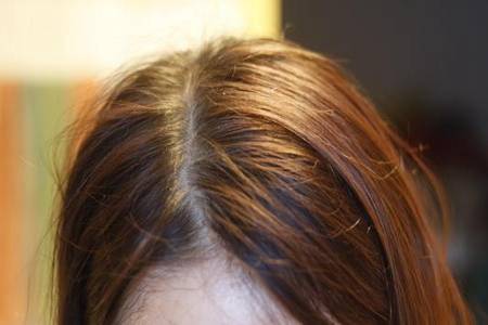 头皮屑多的五大原因,女生拥有清爽头皮的方法