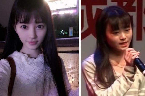 鞠婧祎素颜太吓人 整容前土到不如普通人整容后却大变样