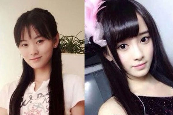 鞠婧祎素颜太吓人 整容前土到不如普通人整容后却大变样