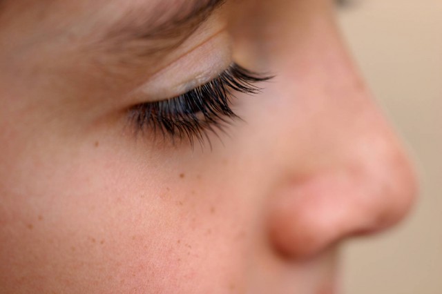 鼻子长痘痘的原因，鼻子长痘痘调理方法