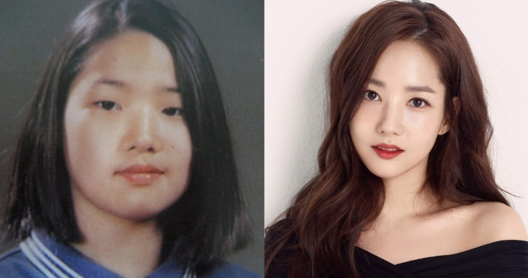 大方承认整容的韩国女星盘点 朴敏英最自然刘寅娜到底动了哪