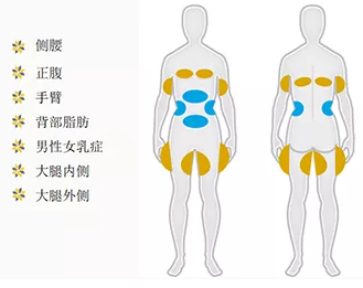 为什么“减肥王者”还是酷塑冷冻减脂？