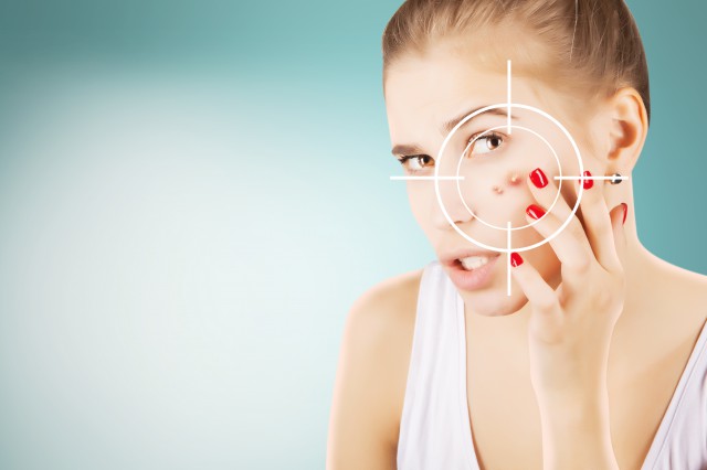 青春痘快速消除小妙招，6招帮你轻松消痘痘