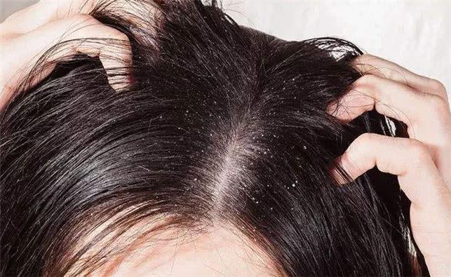 发量少发质细软容易油的小圆脸女生，适合什么样的短发？