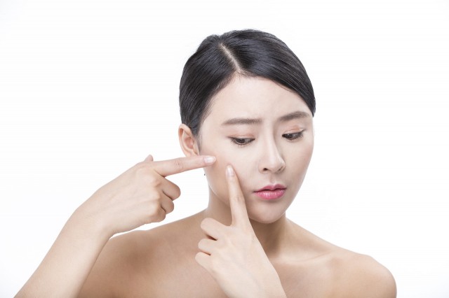 消除脸上痘痘,怎么去脸上痘痘简单方法